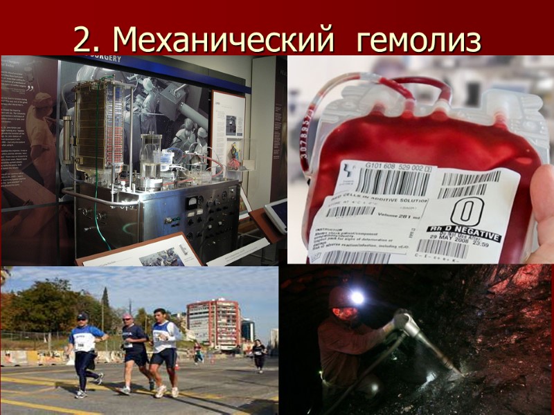 2. Механический  гемолиз